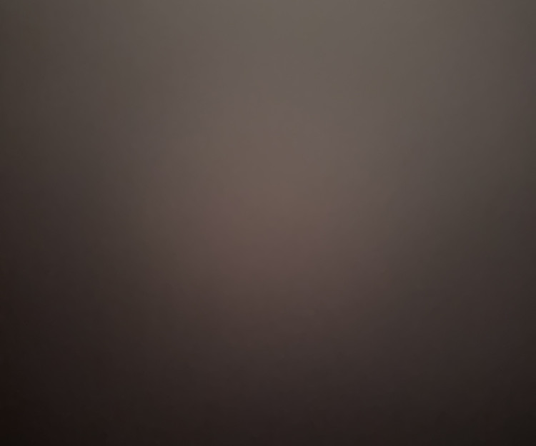 NA